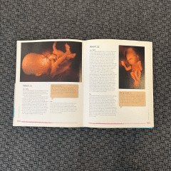 Expecting A Baby Kitap - Oyuncak